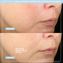 Load image into Gallery viewer, Nuface - Trinity + Effective Lip & Eye Attachment