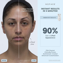 Load image into Gallery viewer, Nuface - Trinity+ Starter Kit
